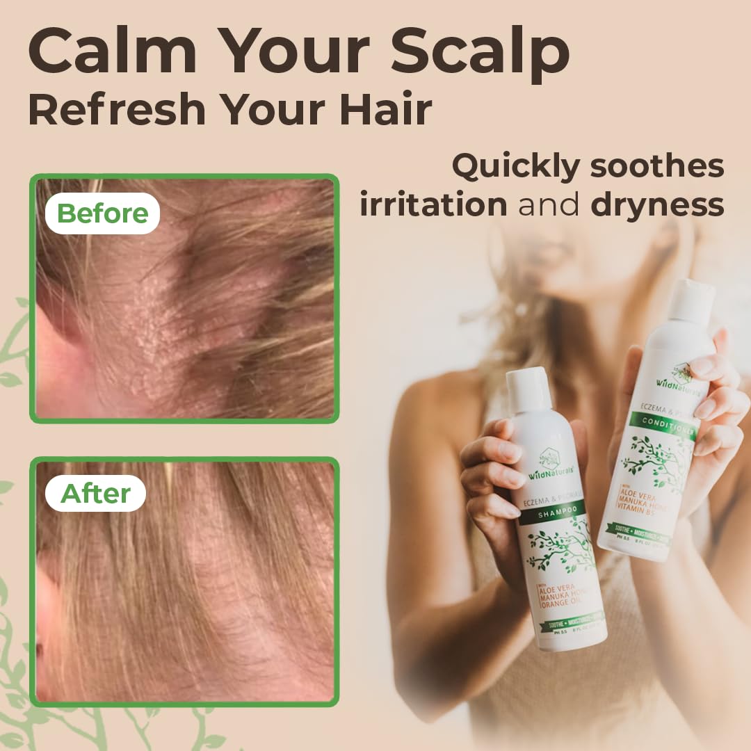 Wild Naturals application on hair and scalp demonstrates soothing massage and hydration