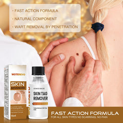 WoTeReVo wart remover applicator cotton swab demonstrates precise, mess-free wart coverage.
