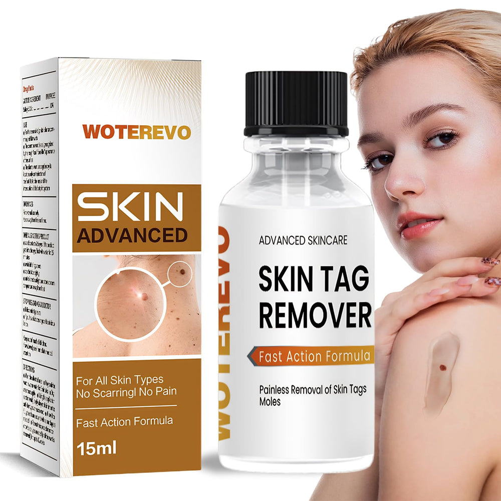 WoTeReVo wart remover bottle label highlights branding and 10% salicylic acid.