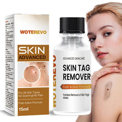 WoTeReVo wart remover bottle label highlights branding and 10% salicylic acid.