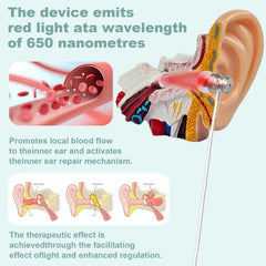 YINGPM 650nm red light ear mode applied to ears for gentle calming care