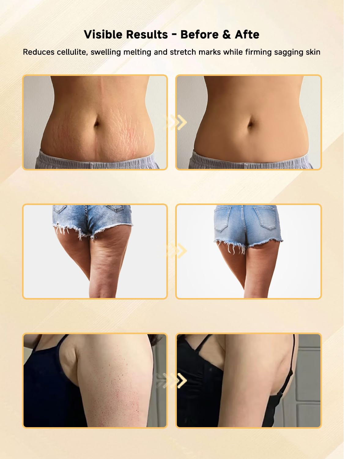 Yisibo Full-body Targeting Design ideal for legs, abdomen, back and more