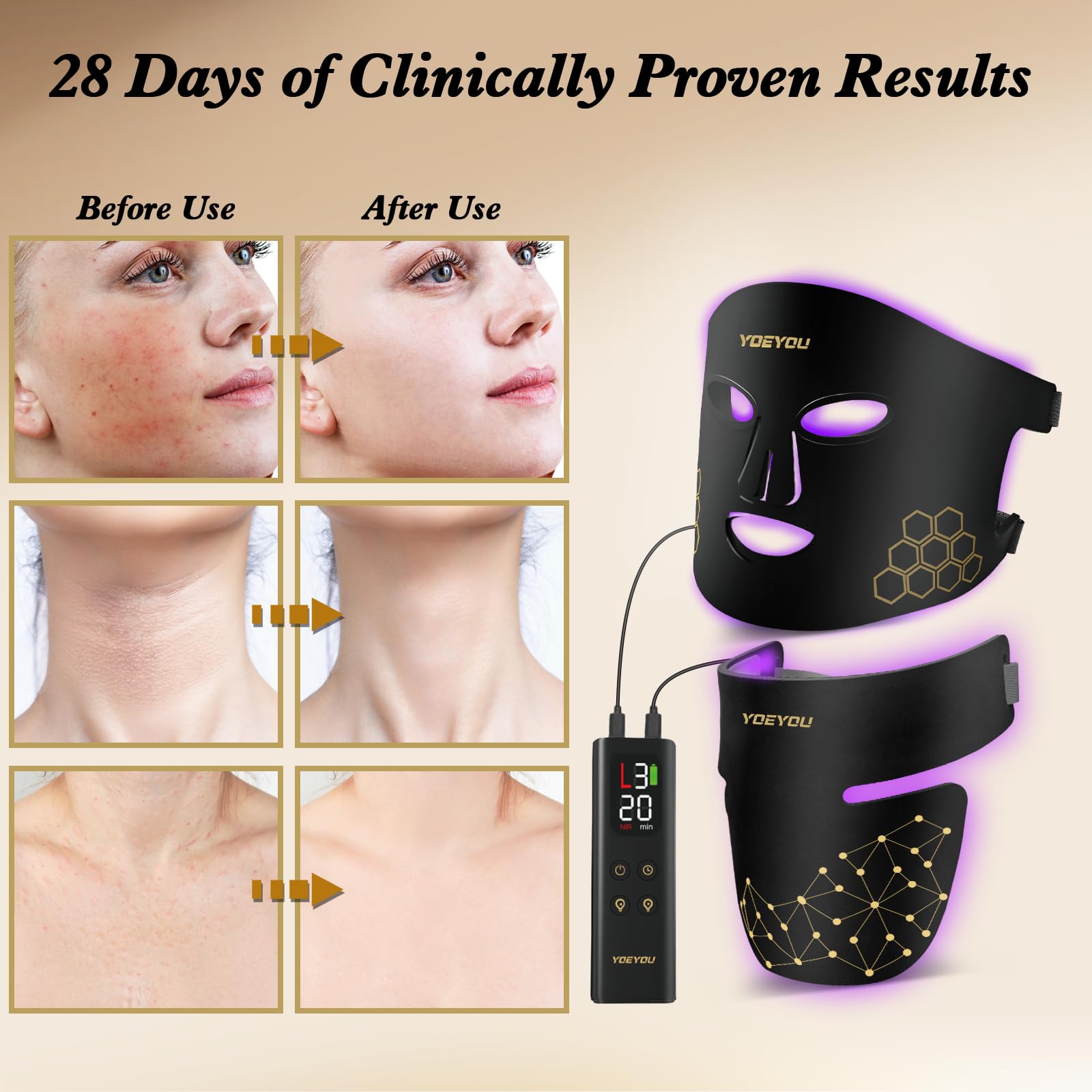 YOEYOU soft silicone frame suitable for all skin types during use