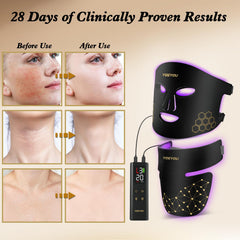 YOEYOU soft silicone frame suitable for all skin types during use