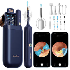 Yumika ear wax camera otoscope provides clear home visuals for safer checks.
