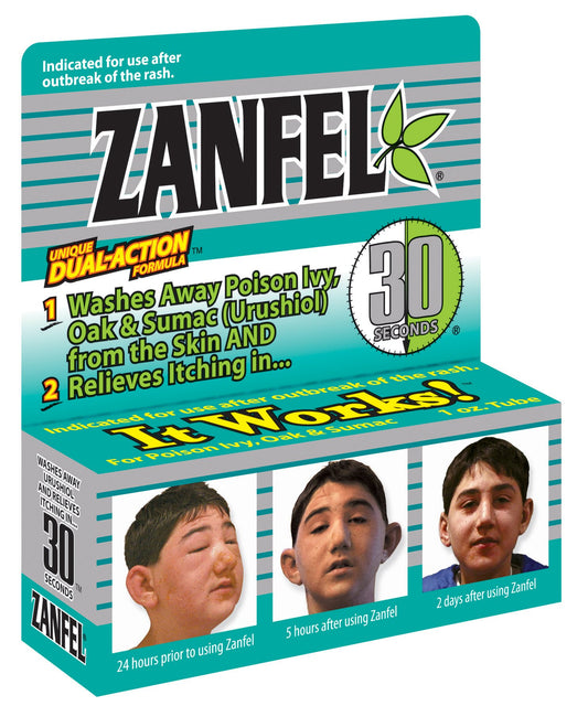 Zanfel poison ivy wash application in action for fast soothing.