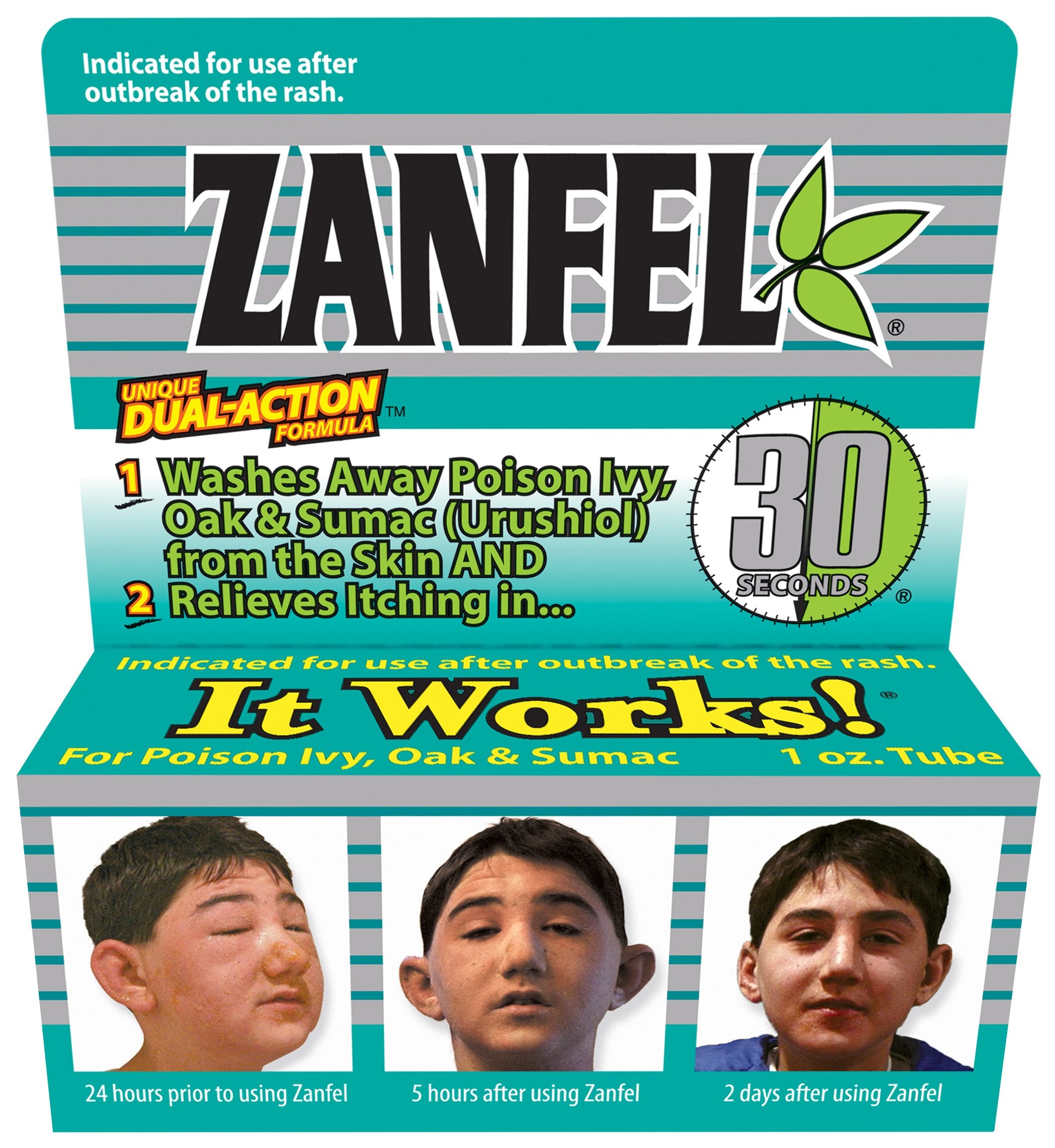 Zanfel poison ivy wash bottle for quick at-home relief.