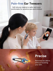 ZERONDER I35R four ear scoop tips for versatile cleaning.