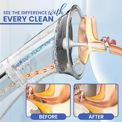 ZEYORA complete ear care kit with soft tips for family use.