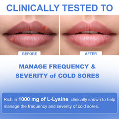Zhizaiql Lysine Cold Sore packaging box for convenient everyday use.