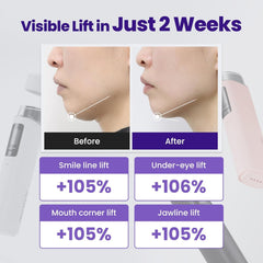 ZIOSTAND Resnovae Core Impact Beauty Massager USB-C recharge for easy power.
