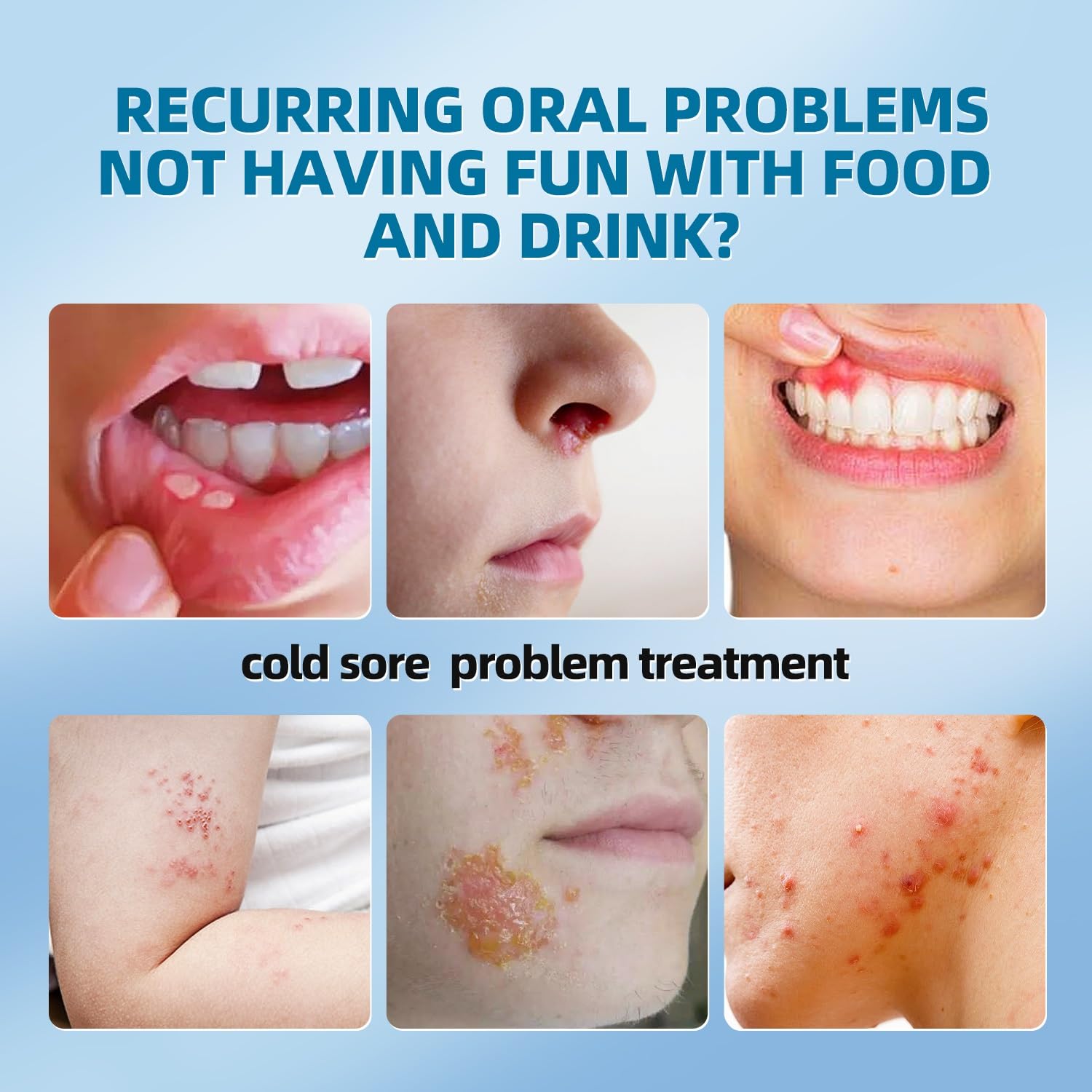 Zobosin safe non-invasive therapy offers a drug-free approach