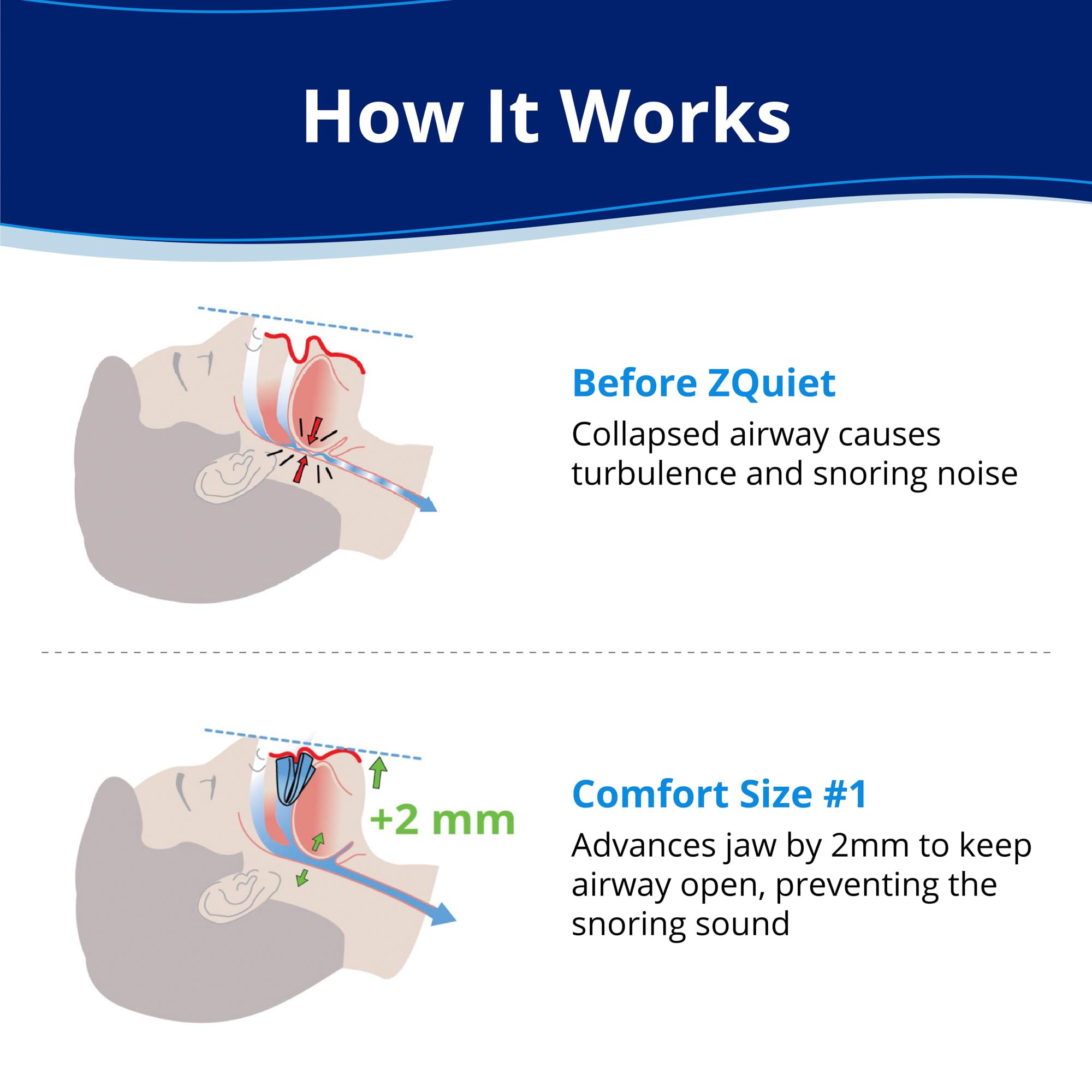 ZQuiet blue refill-size-1 mouthpiece held in hand showing lightweight design