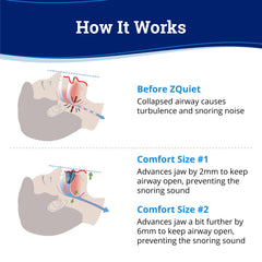 ZQuiet protective storage case keeps mouthpieces organized and clean.