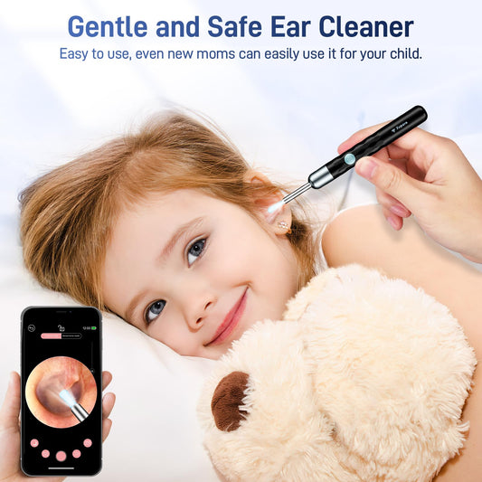 Zupora 3.5mm lens otoscope for versatile ear canal access