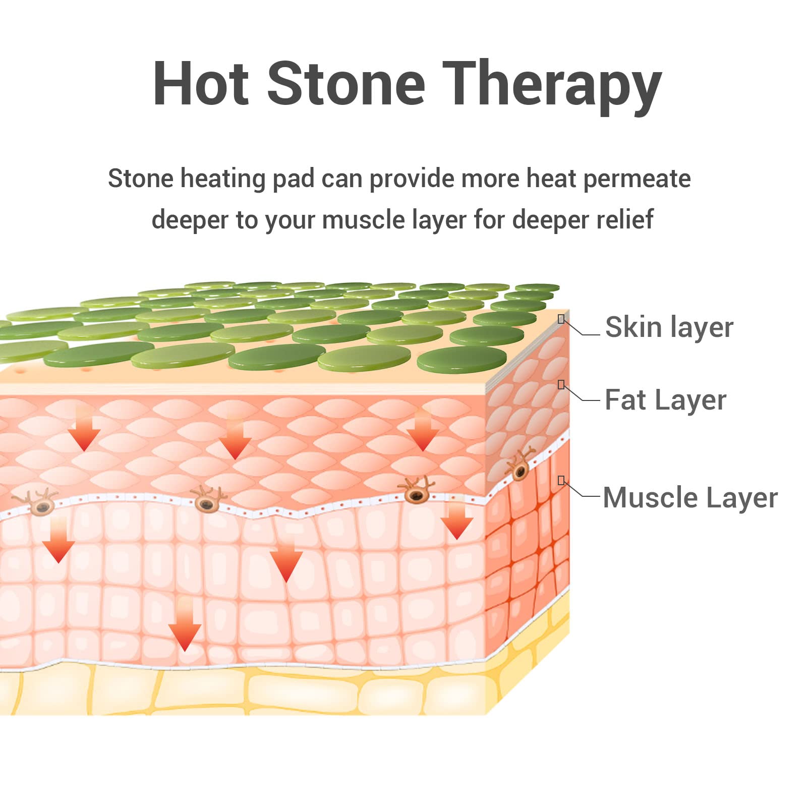 ZXU pad delivers fast, even heat across the target area.