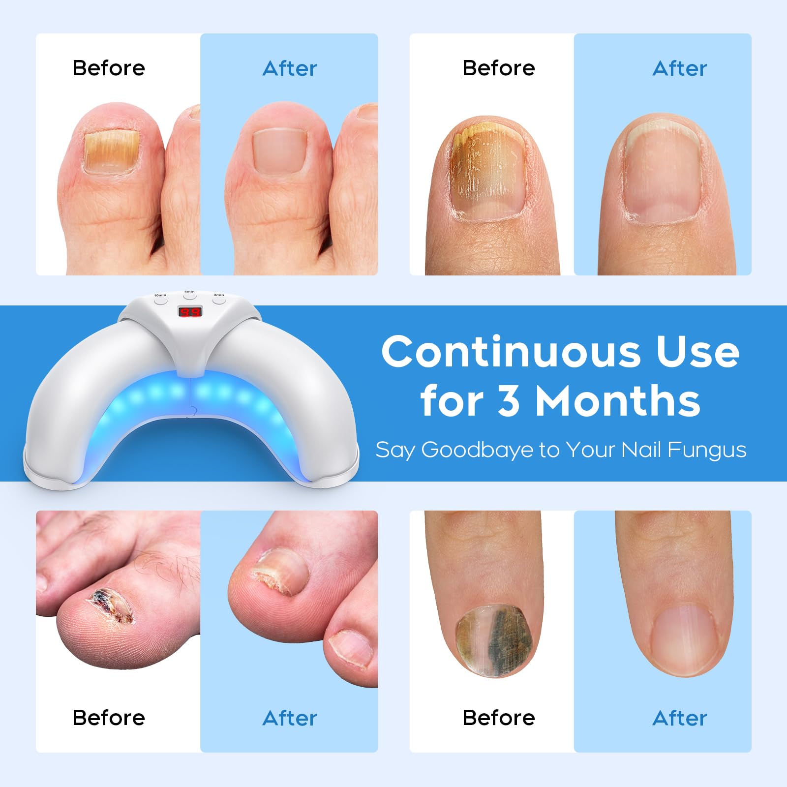 Large design fits all fingers and toenails for efficient sessions.